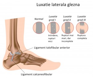 remediu de luxatie articulara articulația primului deget de la picior doare